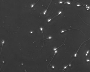 observation morphology of live sperm.